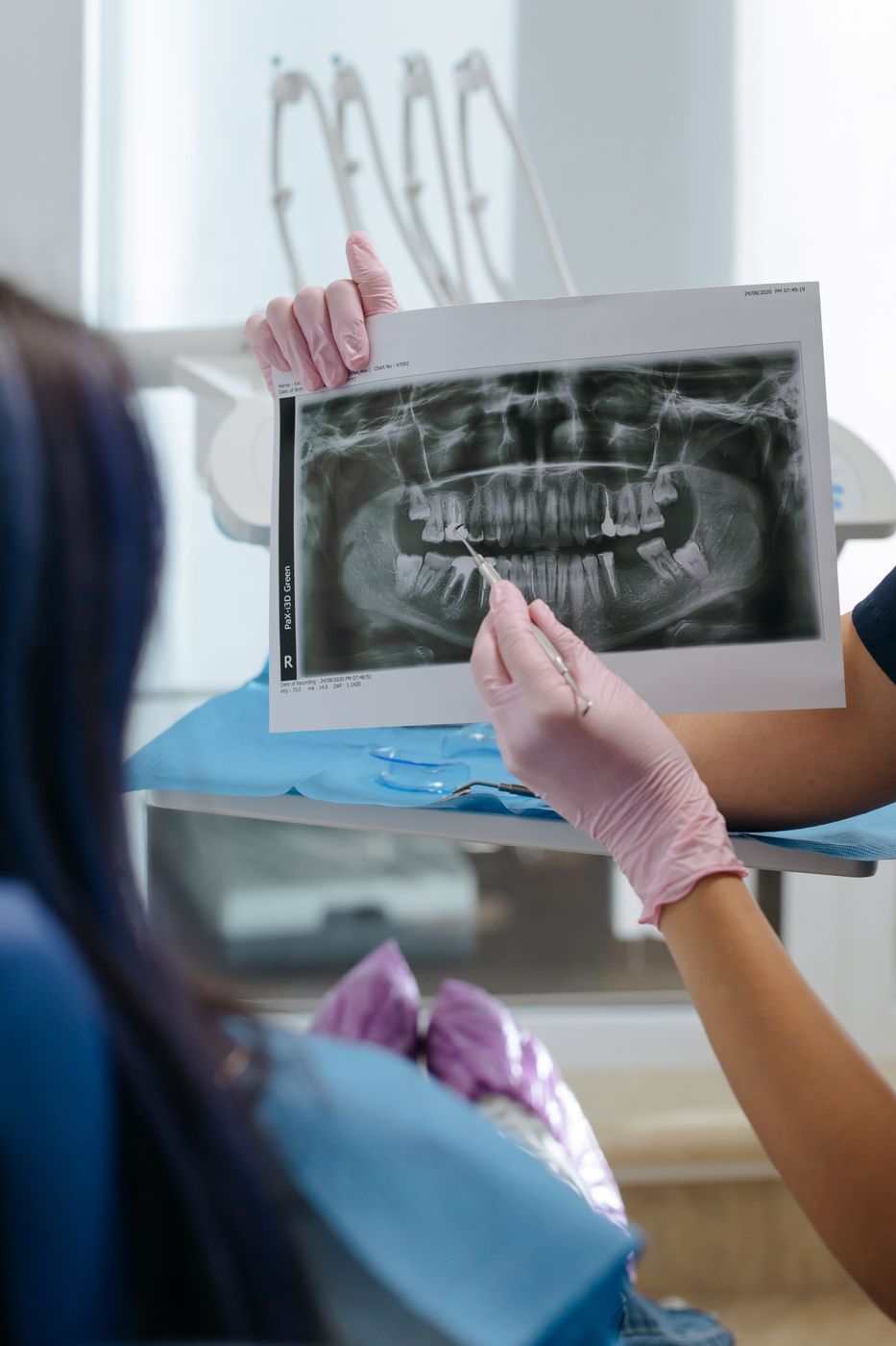 Endodonzia