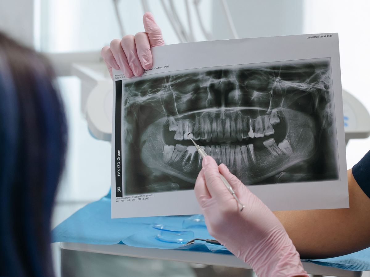La radiografia spiegata al paziente